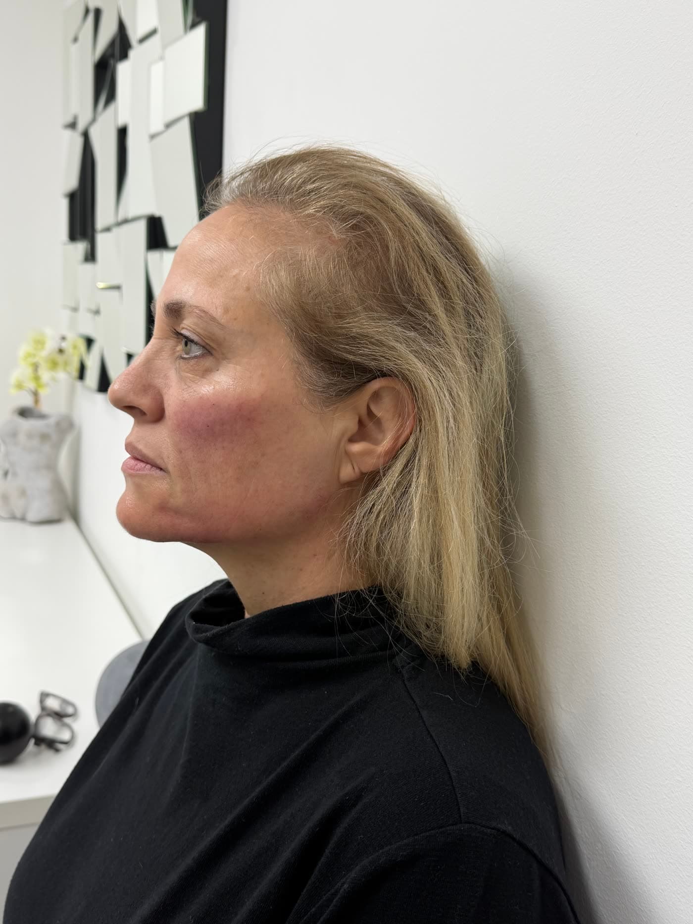 The same patient after treatment