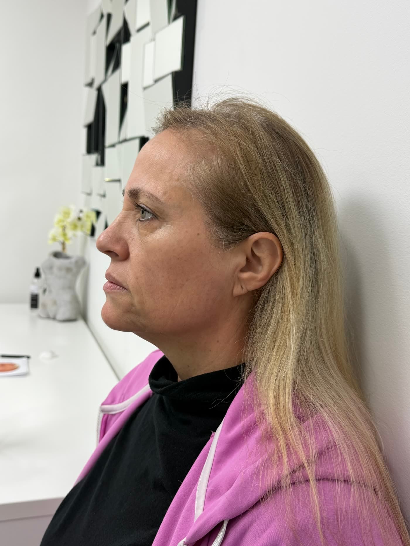 Patient before treatment